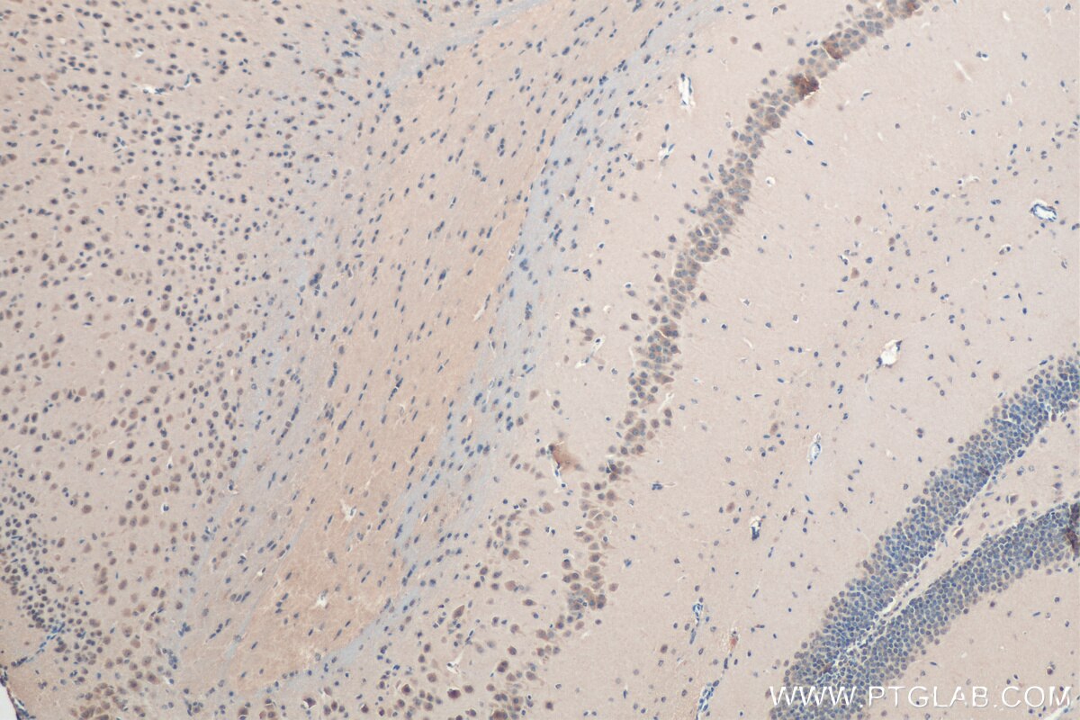 Immunohistochemistry (IHC) staining of mouse brain tissue using SAT1 Polyclonal antibody (10708-1-AP)