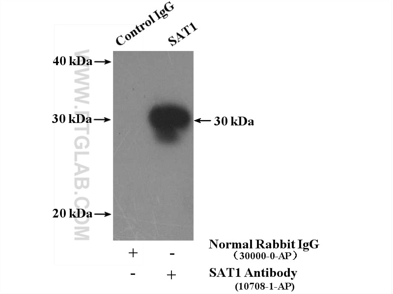 Immunoprecipitation (IP) experiment of mouse liver tissue using SAT1 Polyclonal antibody (10708-1-AP)