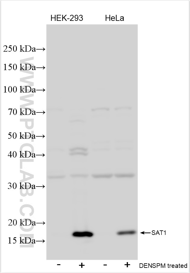 Western Blot (WB) analysis of various lysates using SAT1 Polyclonal antibody (10708-1-AP)
