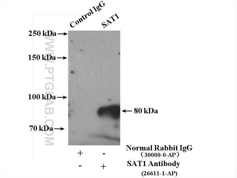 Immunoprecipitation (IP) experiment of mouse kidney tissue using SAT1 Polyclonal antibody (26611-1-AP)