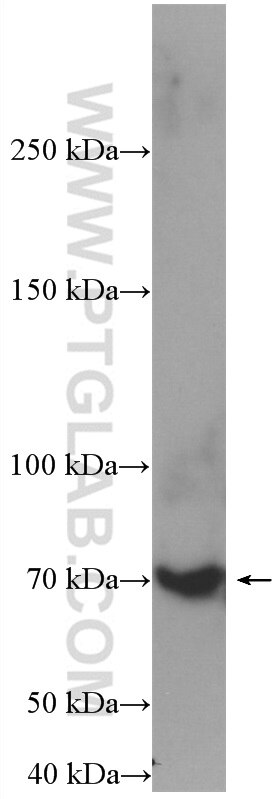 Western Blot (WB) analysis of mouse spleen tissue using SAT1 Polyclonal antibody (26611-1-AP)