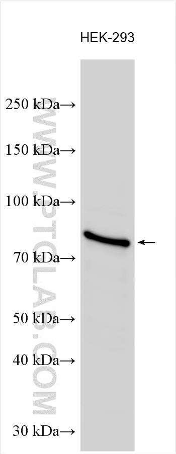 Western Blot (WB) analysis of HEK-293 cells using SAT1 Polyclonal antibody (26611-1-AP)