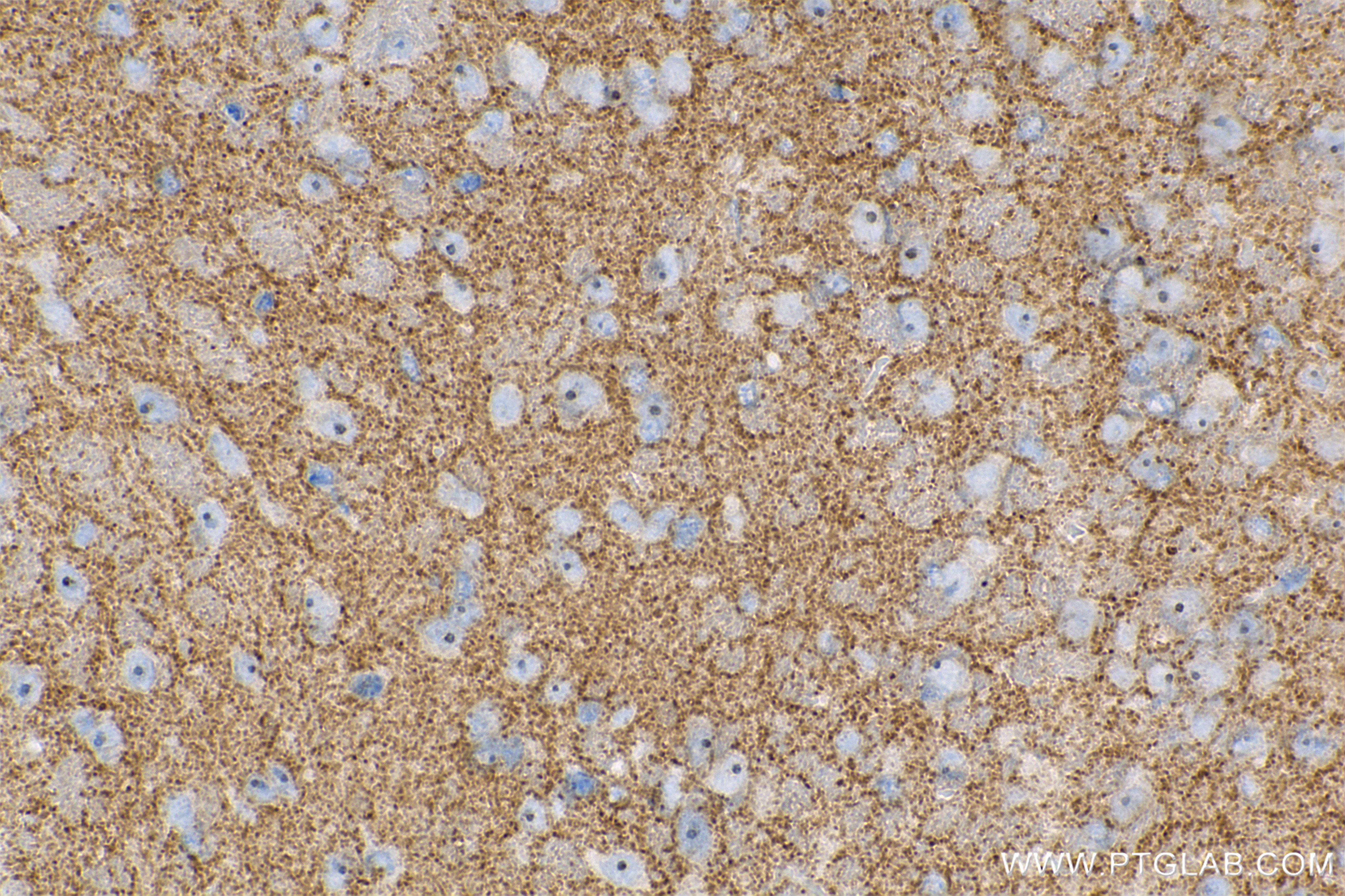 Immunohistochemistry (IHC) staining of mouse brain tissue using SAT1 Recombinant antibody (83319-1-RR)