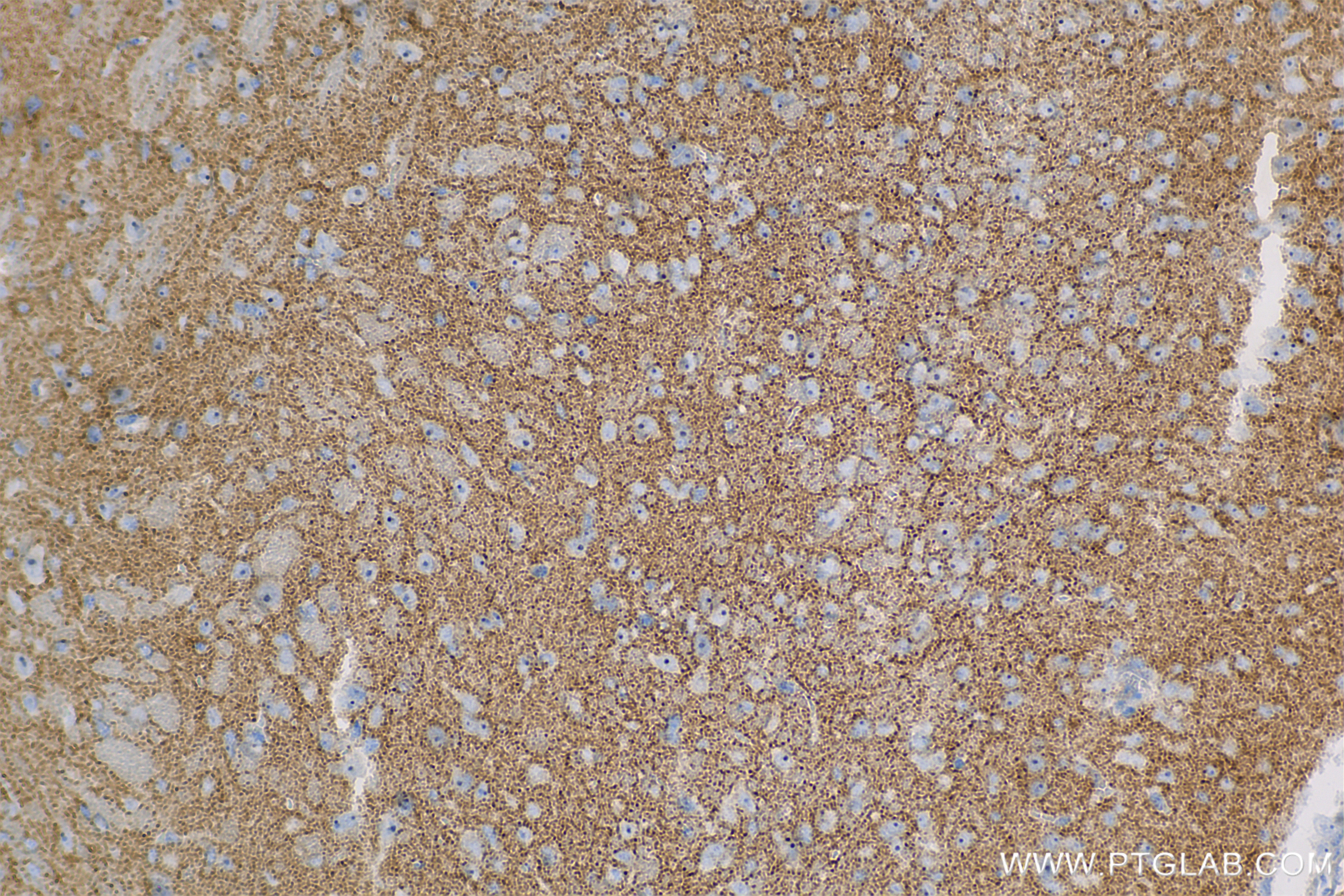 Immunohistochemistry (IHC) staining of mouse brain tissue using SAT1 Recombinant antibody (83319-1-RR)