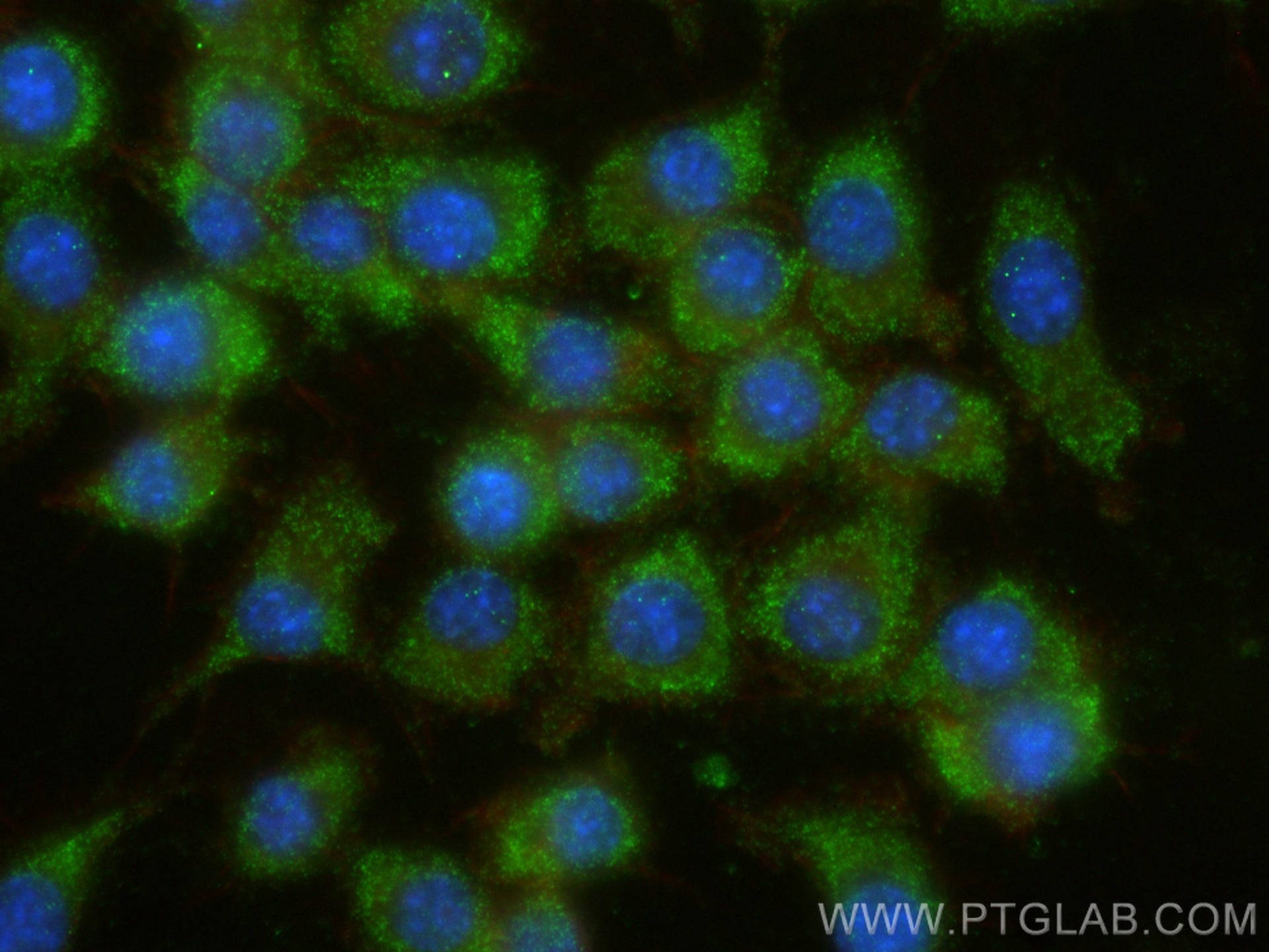 Immunofluorescence (IF) / fluorescent staining of RAW 264.7 cells using Multi-rAb™ SAT1 Multi-Recombinant antibody (RMX00008)