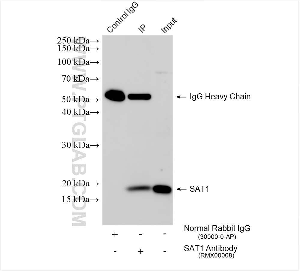 IP result of anti-SAT1 (IP:RMX00008, 4ug; Detection:RMX00008 1:1500) with DENSPM treated HEK-293 cells lysate 1288 ug. Immunoprecipitation (IP) experiment of HEK-293 cells using SAT1 Multi-Recombinant antibody (RMX00008)