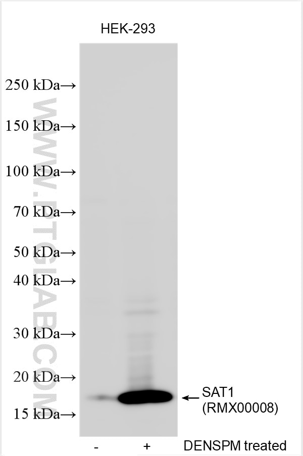 Western Blot (WB) analysis of various lysates using Multi-rAb™ SAT1 Multi-Recombinant antibody (RMX00008)