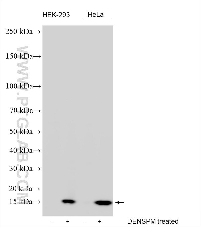 WB analysis using RMX00008 Western Blot (WB) analysis of various lysates using Multi-rAb® SAT1 Multi-Recombinant antibody (RMX00008)