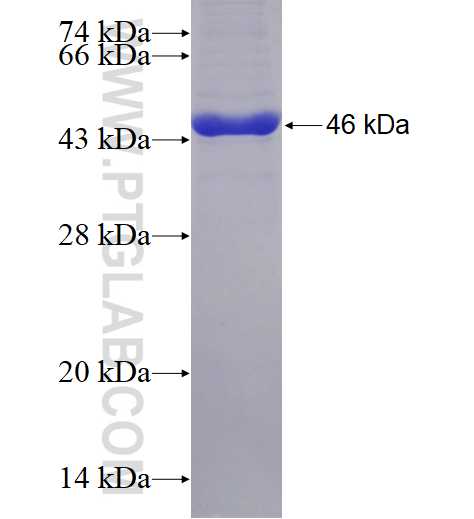 SAT1 fusion protein Ag1154 SDS-PAGE