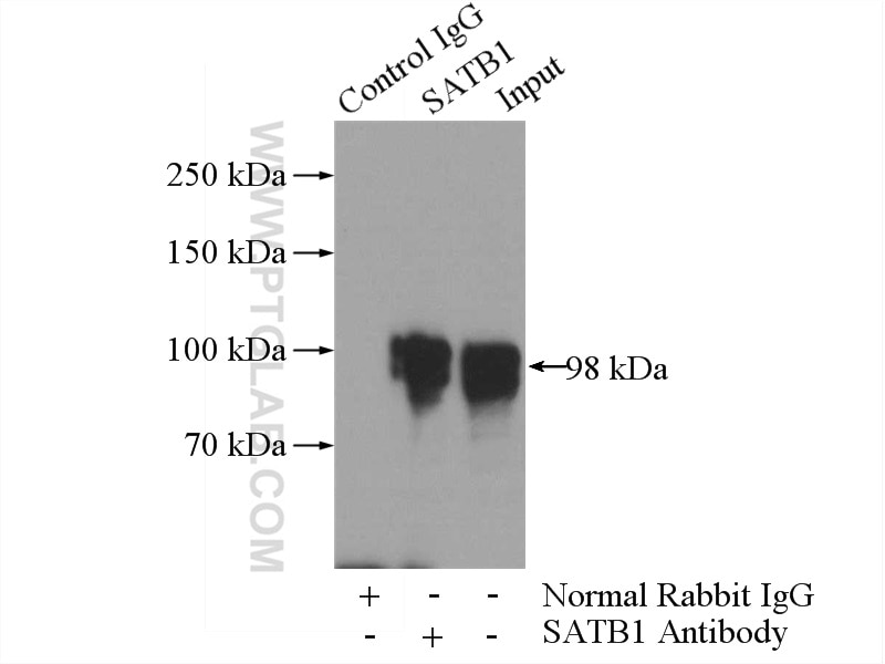 Immunoprecipitation (IP) experiment of HEK-293 cells using SATB1 Polyclonal antibody (15400-1-AP)