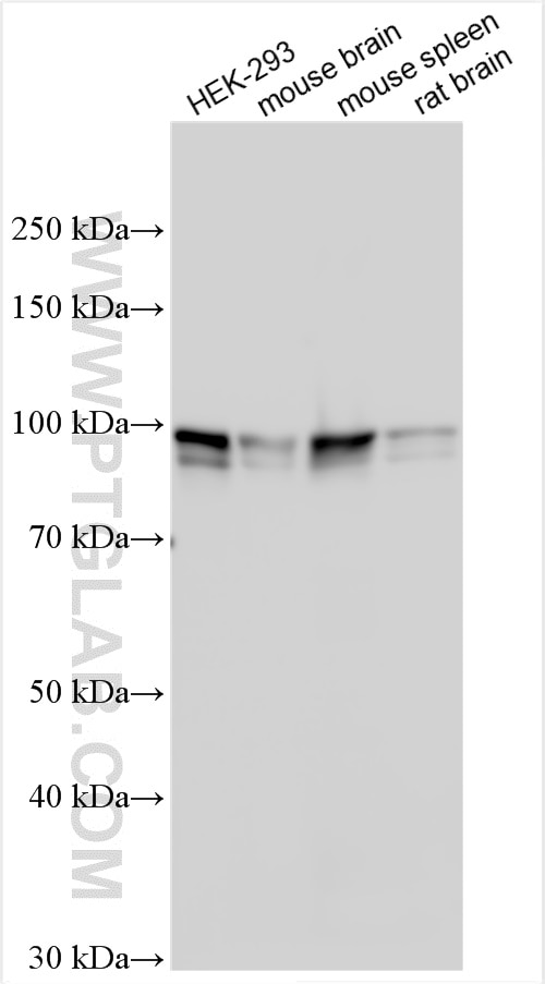 Western Blot (WB) analysis of various lysates using SATB1 Polyclonal antibody (15400-1-AP)