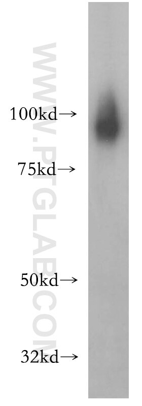 Western Blot (WB) analysis of human brain tissue using SATB1 Polyclonal antibody (15400-1-AP)