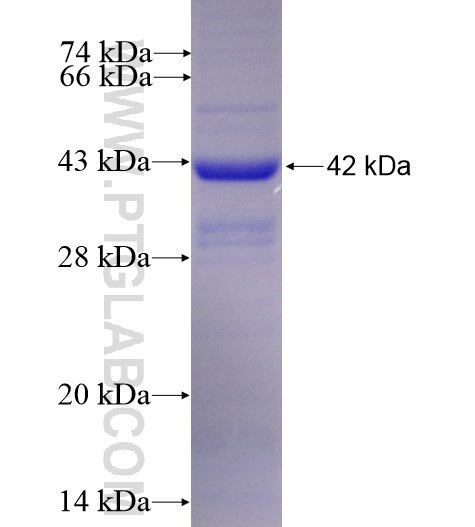SATB1 fusion protein Ag12278 SDS-PAGE