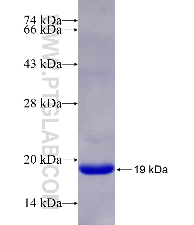 SATB1 fusion protein Ag12279 SDS-PAGE