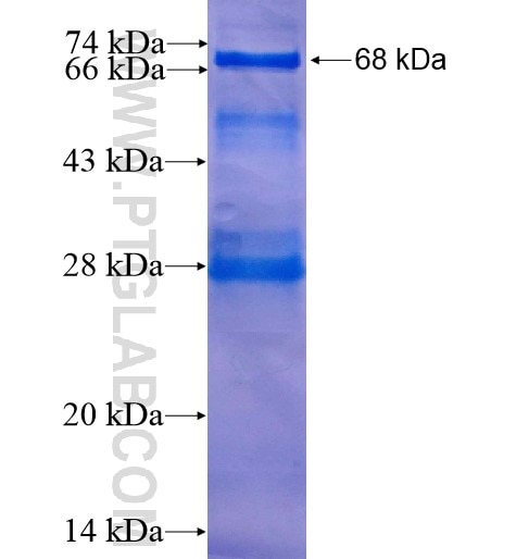 SATB1 fusion protein Ag7615 SDS-PAGE