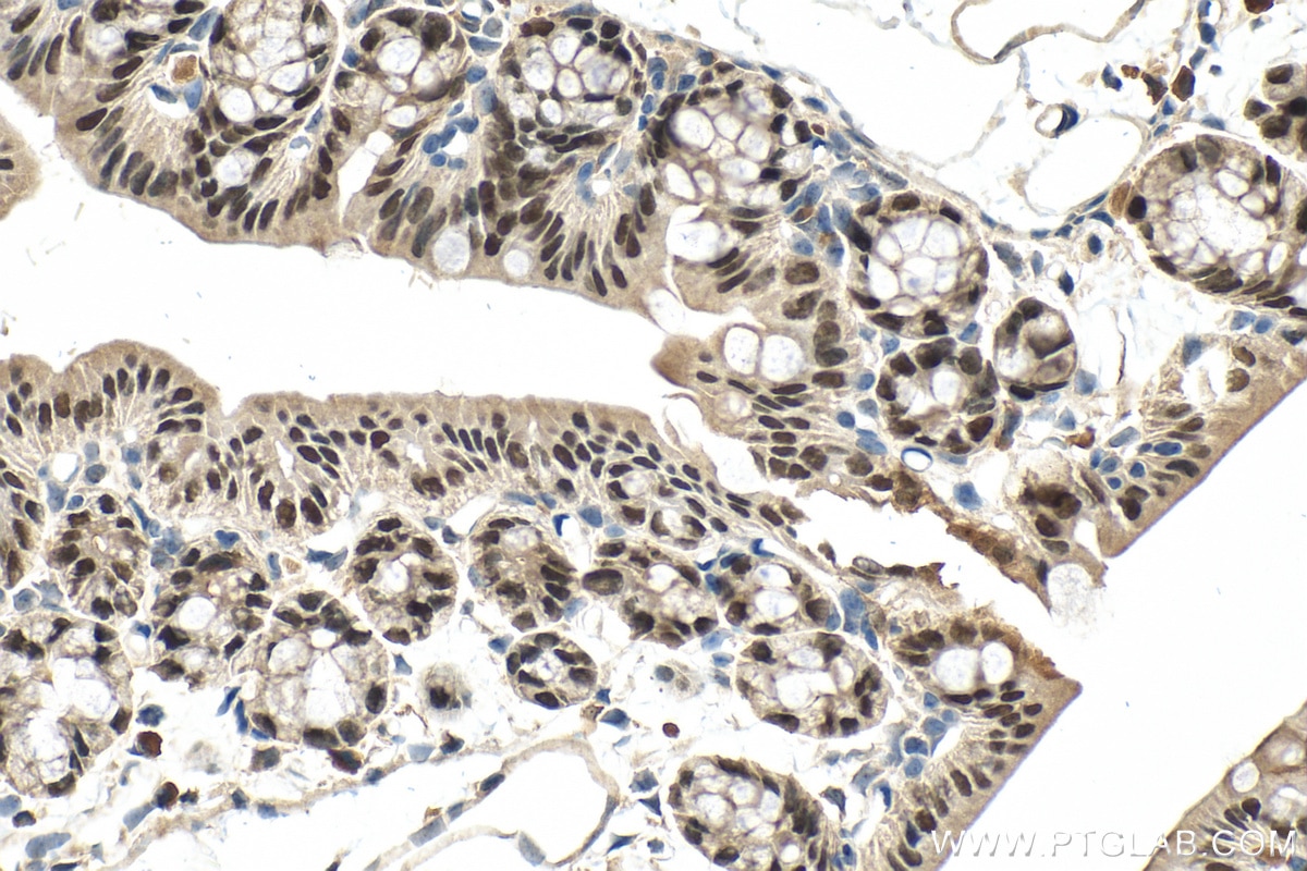 Immunohistochemistry (IHC) staining of mouse colon tissue using SATB2 Polyclonal antibody (19557-1-AP)