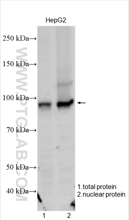 Western Blot (WB) analysis of various lysates using SATB2 Polyclonal antibody (19557-1-AP)