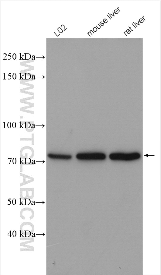 Western Blot (WB) analysis of various lysates using SATB2 Polyclonal antibody (21307-1-AP)