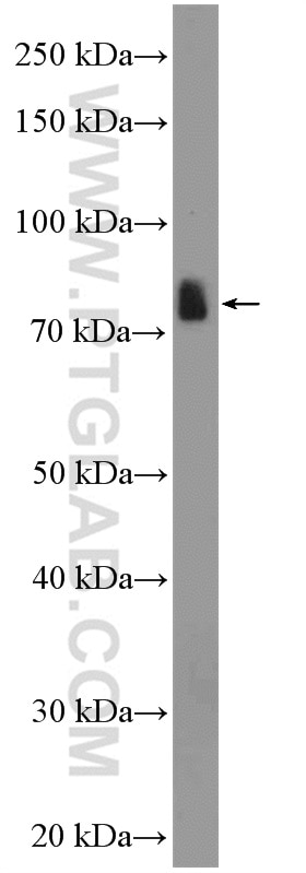 Western Blot (WB) analysis of mouse liver tissue using SATB2 Polyclonal antibody (21307-1-AP)