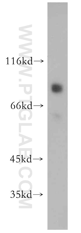 Western Blot (WB) analysis of human brain tissue using SATB2 Polyclonal antibody (21307-1-AP)