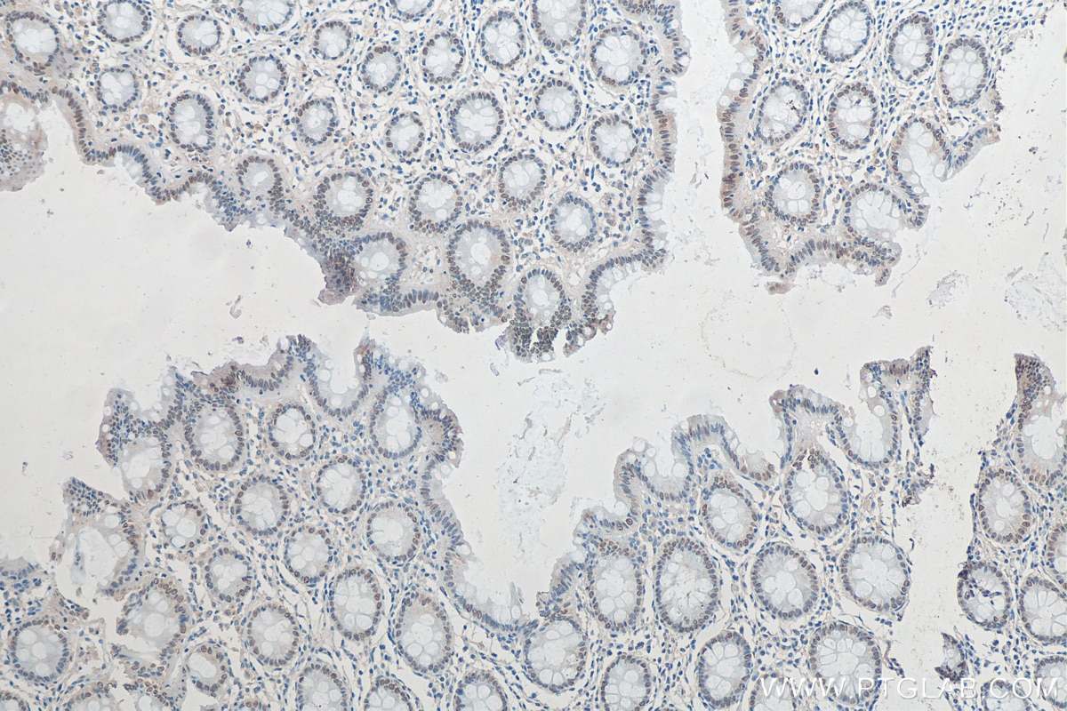 Immunohistochemistry (IHC) staining of human colon tissue using SATB2 Monoclonal antibody (67958-1-Ig)