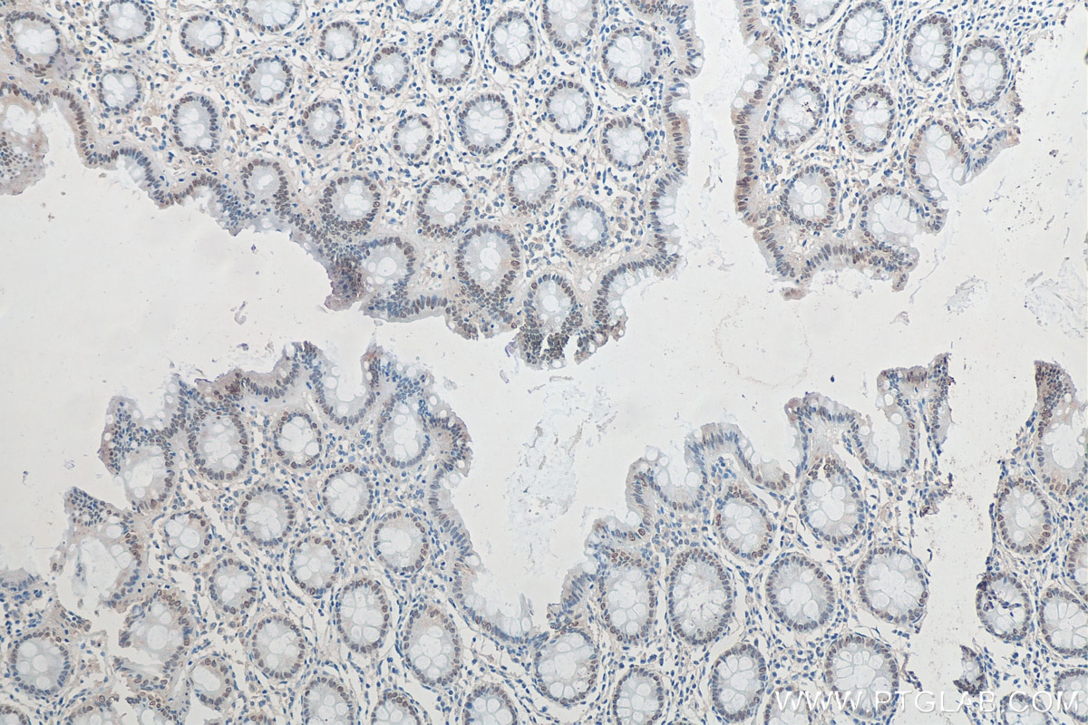 IHC staining of human colon using 67958-1-Ig