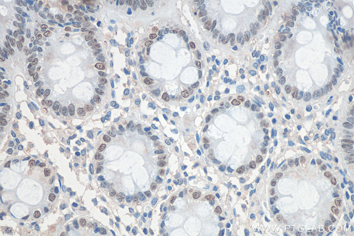 Immunohistochemistry (IHC) staining of human colon tissue using SATB2 Monoclonal antibody (67958-1-Ig)
