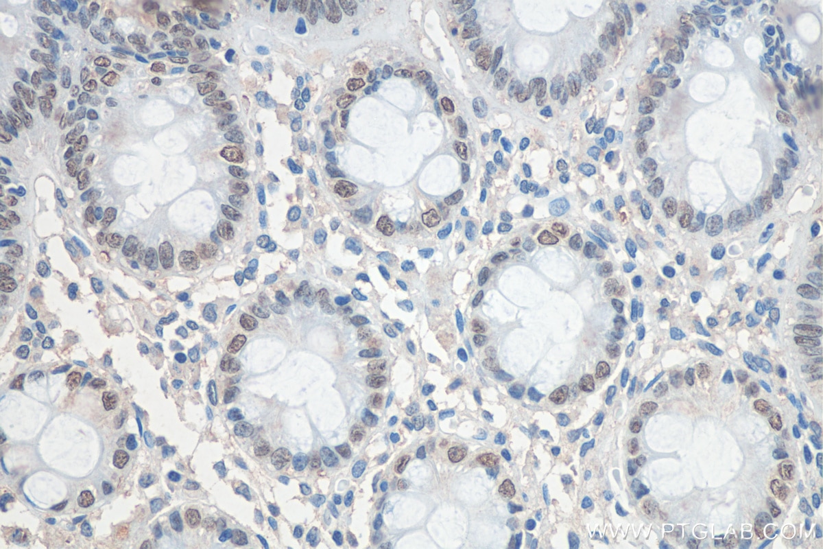 IHC staining of human colon using 67958-1-Ig