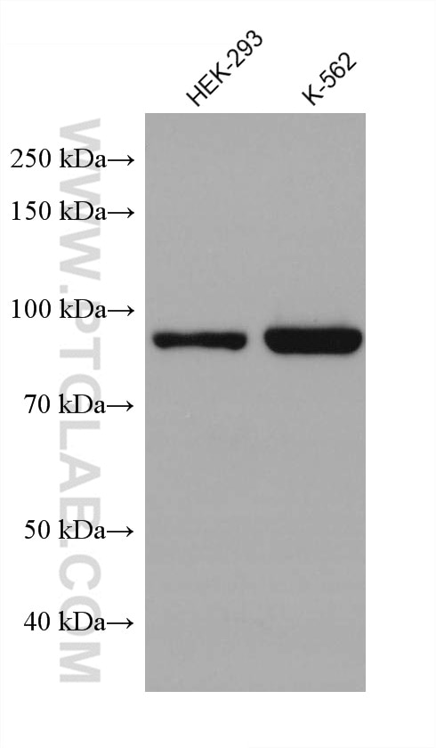 Western Blot (WB) analysis of various lysates using SATB2 Monoclonal antibody (67958-1-Ig)