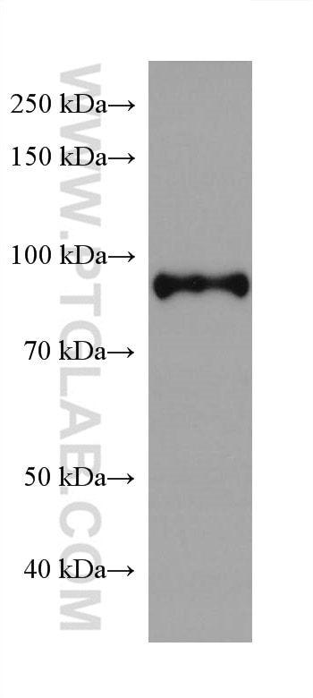 Western Blot (WB) analysis of fetal human brain tissue using SATB2 Monoclonal antibody (67958-1-Ig)