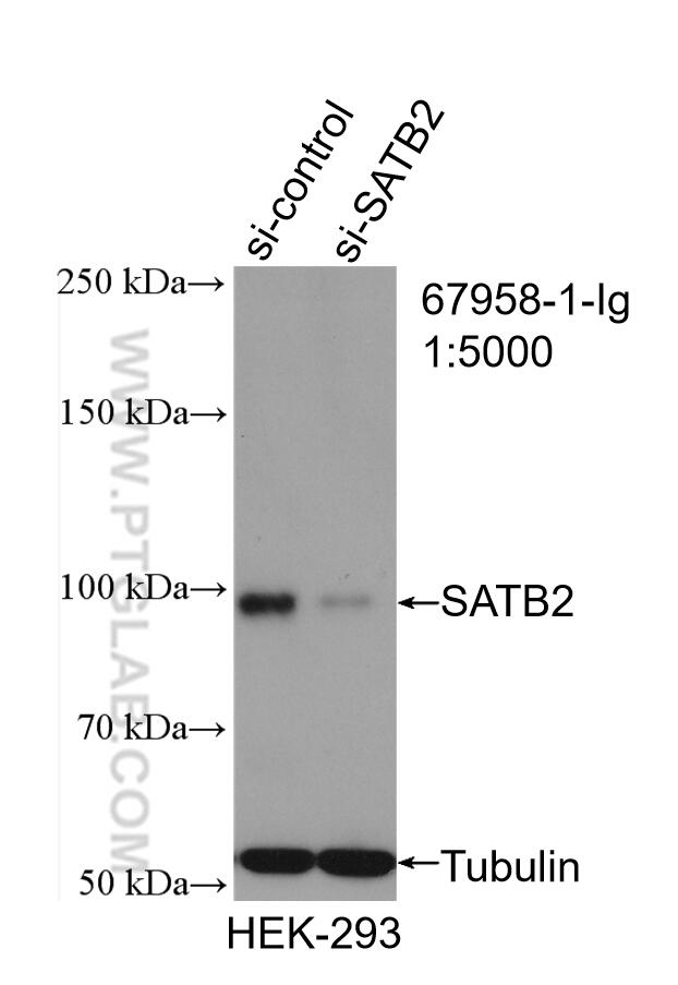 Western Blot (WB) analysis of HEK-293 cells using SATB2 Monoclonal antibody (67958-1-Ig)