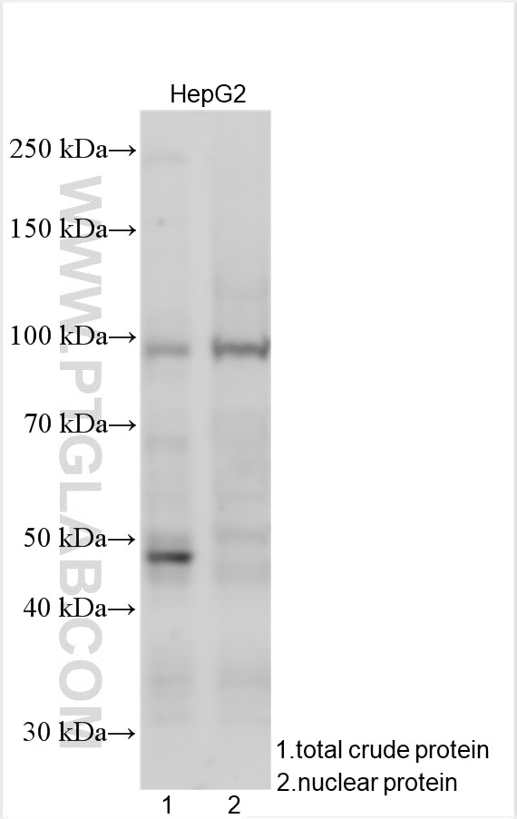 Western Blot (WB) analysis of various lysates using SATB2 Monoclonal antibody (67958-1-Ig)