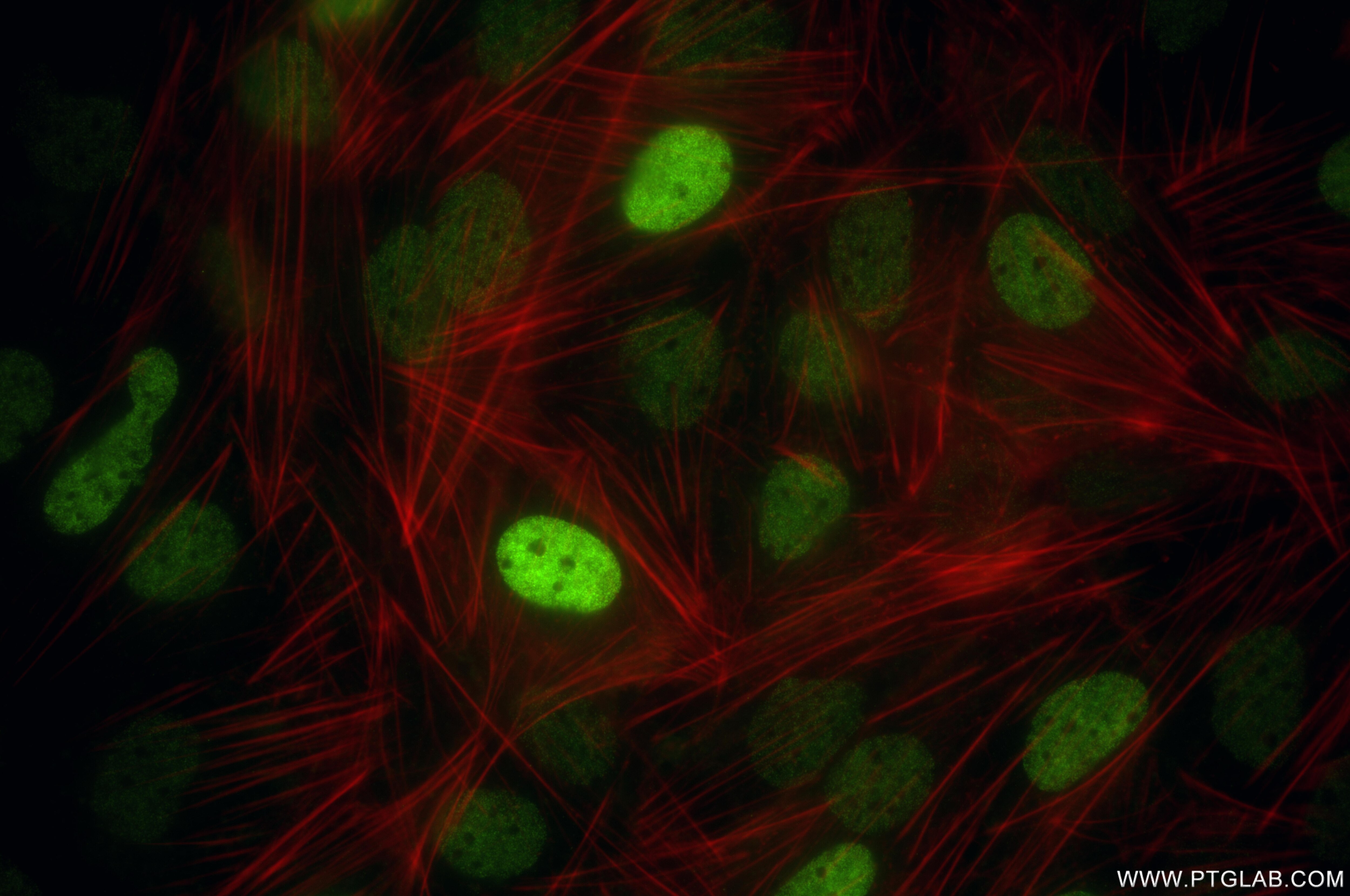 Immunofluorescence (IF) / fluorescent staining of Saos-2 cells using SATB2 Recombinant monoclonal antibody (85922-1-RR)