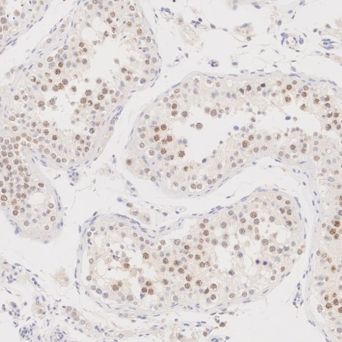 IHC staining of human testis using 85922-1-RR Immunohistochemistry (IHC) staining of human testis tissue using SATB2 Recombinant monoclonal antibody (85922-1-RR)