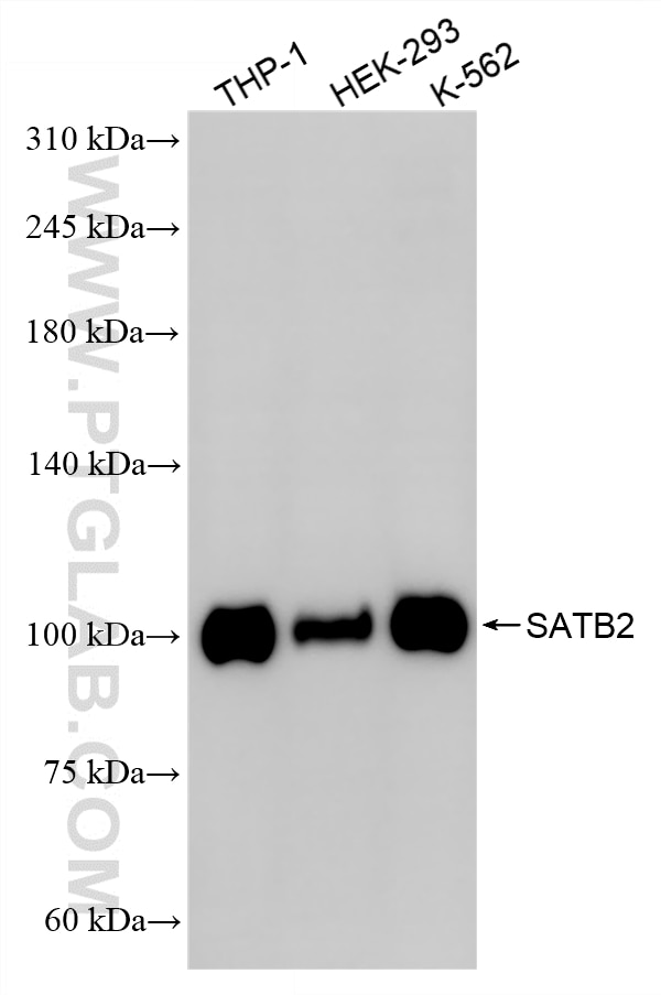 Western Blot (WB) analysis of various lysates using SATB2 Recombinant monoclonal antibody (85922-1-RR)