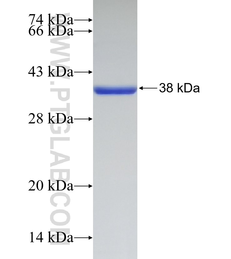 SATB2 fusion protein Ag33523 SDS-PAGE