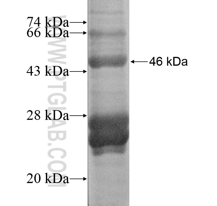 SATB2 fusion protein Ag15920 SDS-PAGE