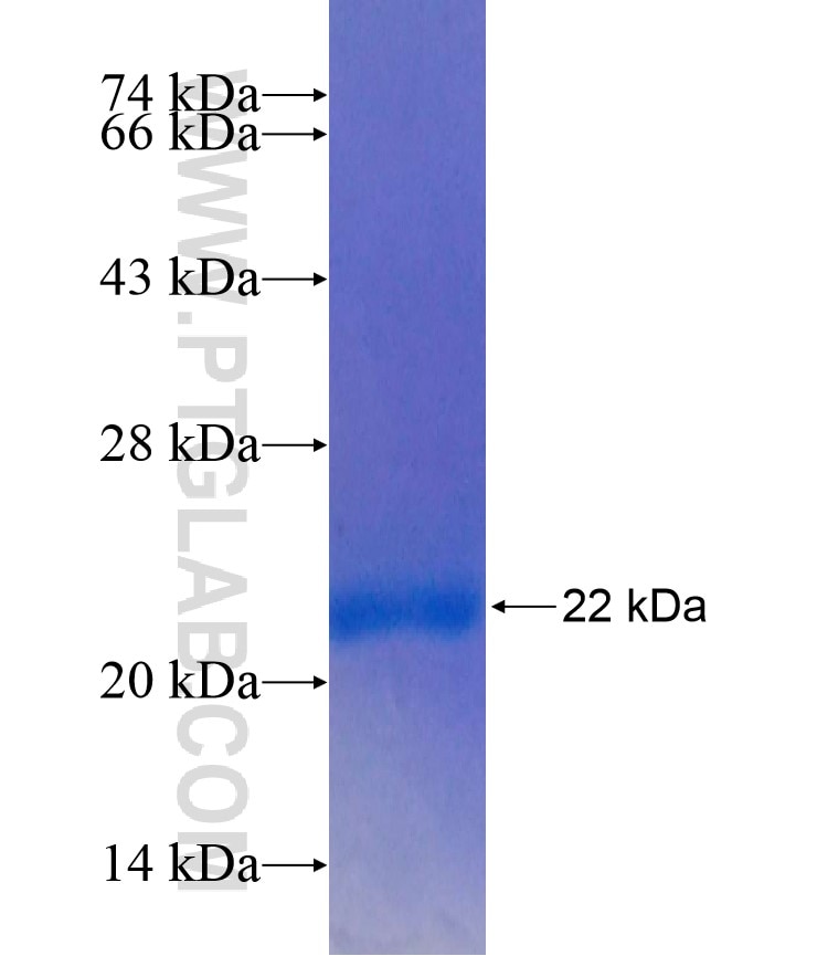 SATB2 fusion protein Ag17237 SDS-PAGE