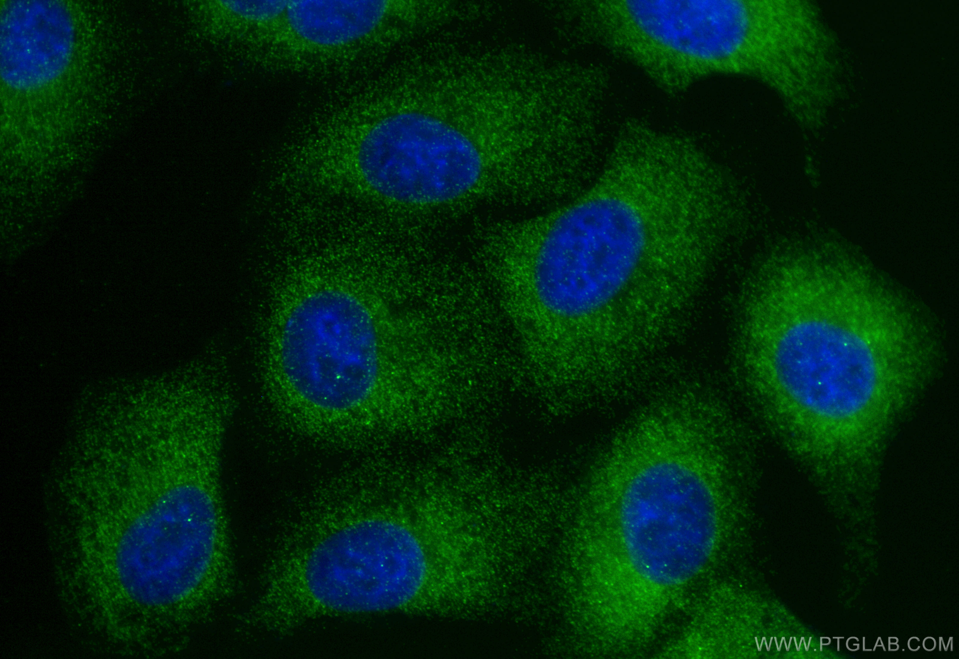 Immunofluorescence (IF) / fluorescent staining of A549 cells using SAV1 Polyclonal antibody (32277-1-AP)