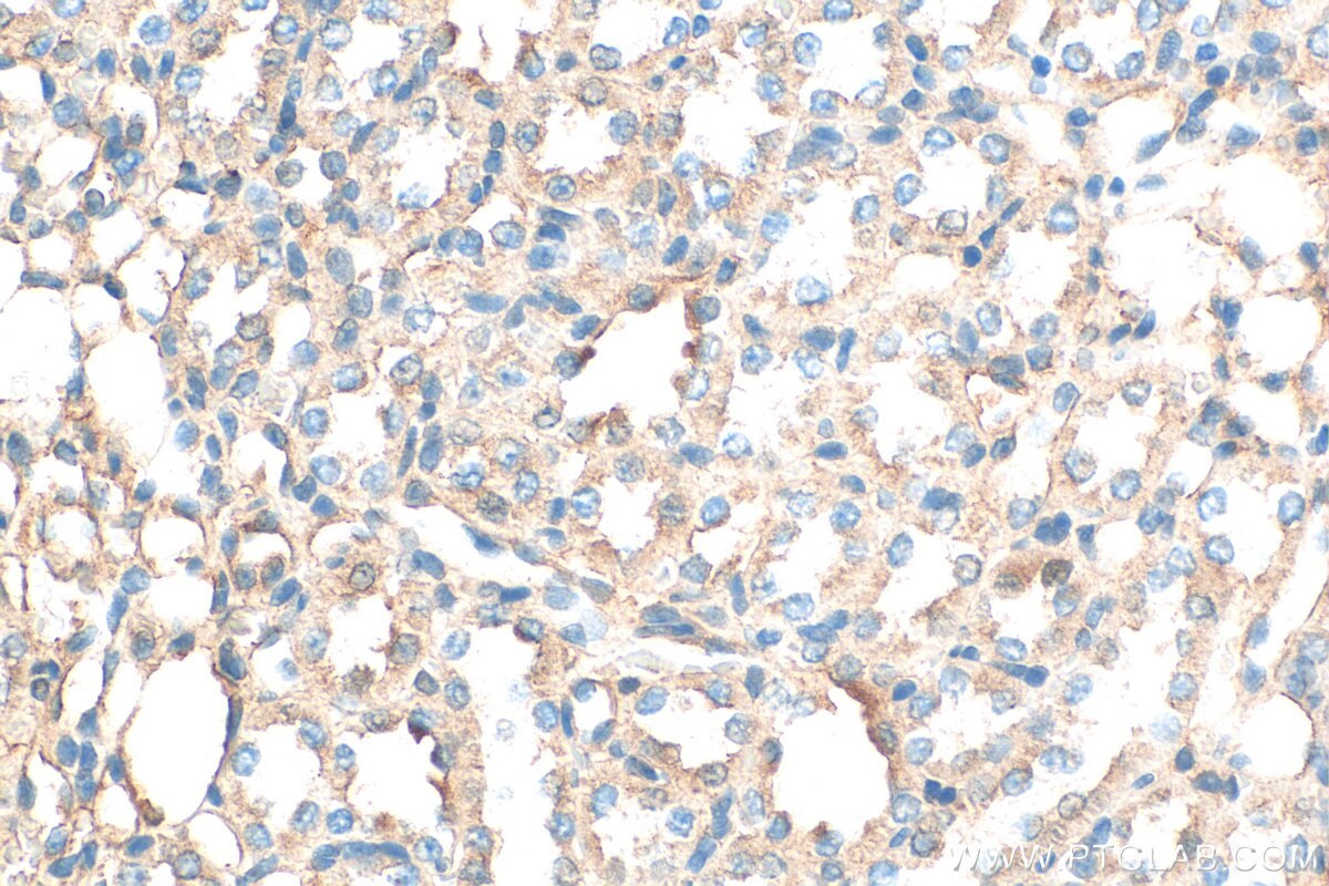 Immunohistochemistry (IHC) staining of rat kidney tissue using SAV1 Polyclonal antibody (32277-1-AP)
