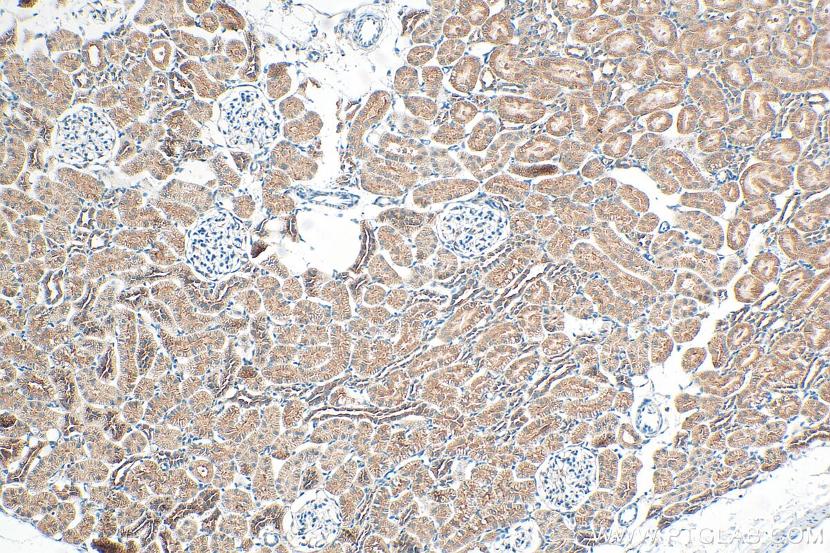 Immunohistochemistry (IHC) staining of rat kidney tissue using SAV1 Polyclonal antibody (32277-1-AP)