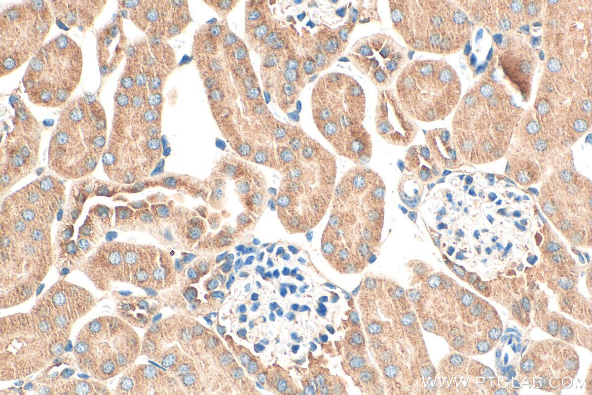 Immunohistochemistry (IHC) staining of mouse kidney tissue using SAV1 Polyclonal antibody (32277-1-AP)