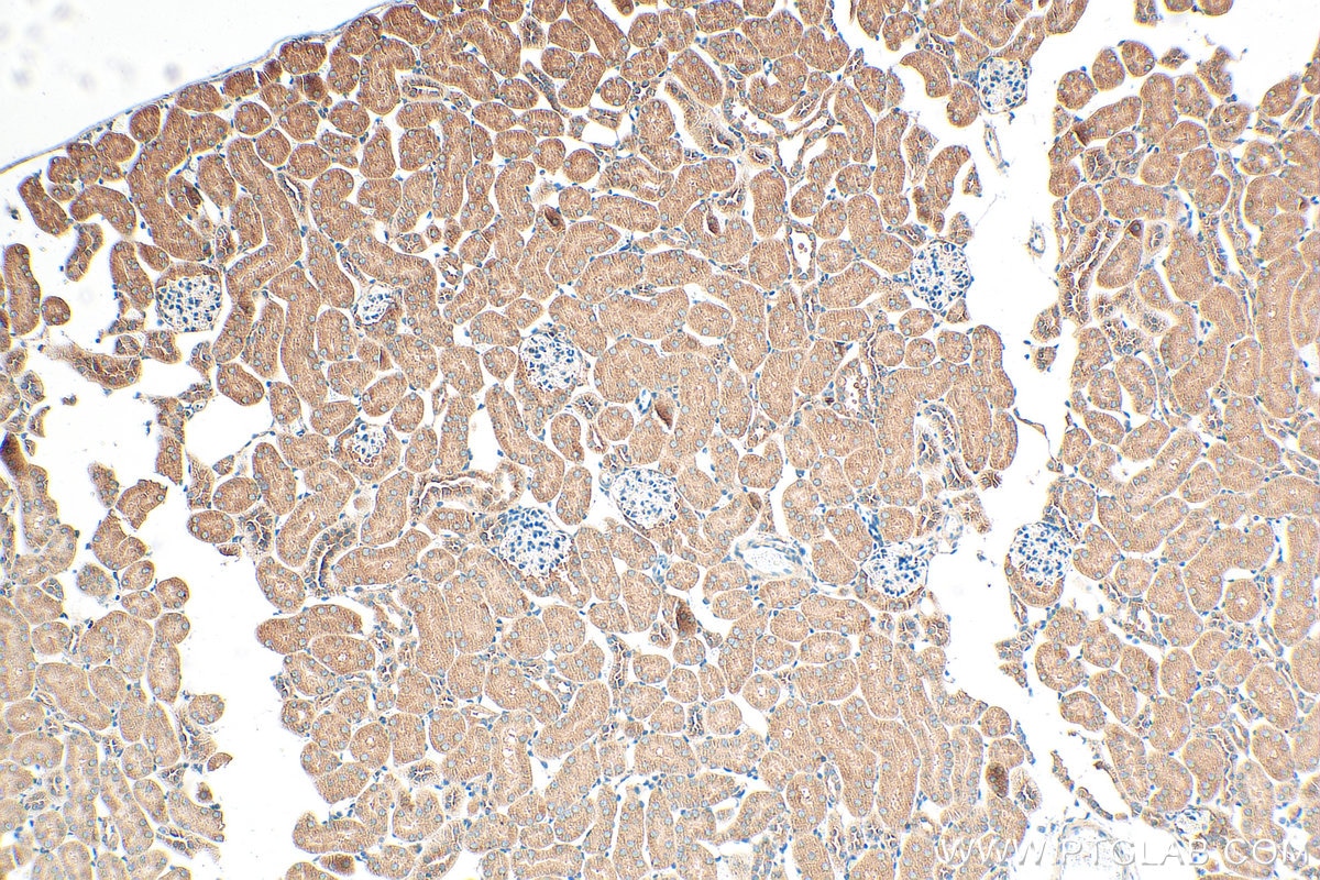 Immunohistochemistry (IHC) staining of mouse kidney tissue using SAV1 Polyclonal antibody (32277-1-AP)
