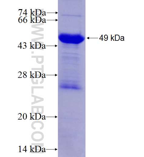 SAV1 fusion protein Ag3441 SDS-PAGE