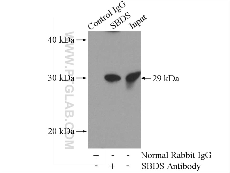 Immunoprecipitation (IP) experiment of HL-60 cells using SBDS Polyclonal antibody (17618-1-AP)