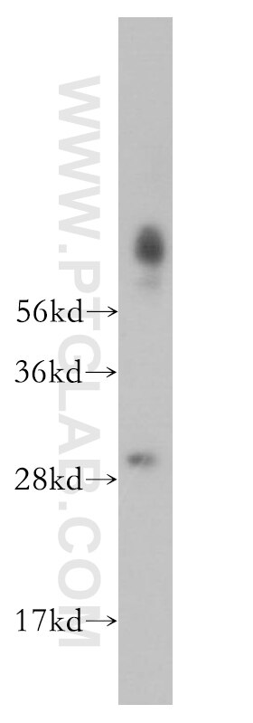 Western Blot (WB) analysis of SH-SY5Y cells using SBDS Polyclonal antibody (17618-1-AP)