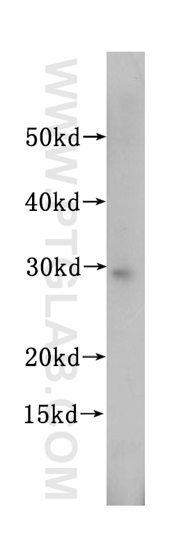 Western Blot (WB) analysis of HL-60 cells using SBDS Polyclonal antibody (17618-1-AP)