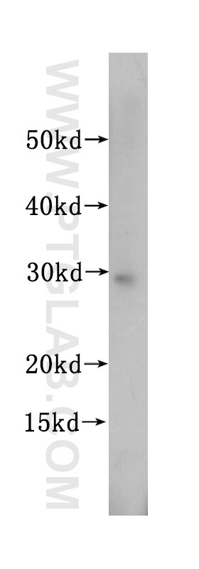 Western Blot (WB) analysis of HL-60 cells using SBDS Polyclonal antibody (17618-1-AP)