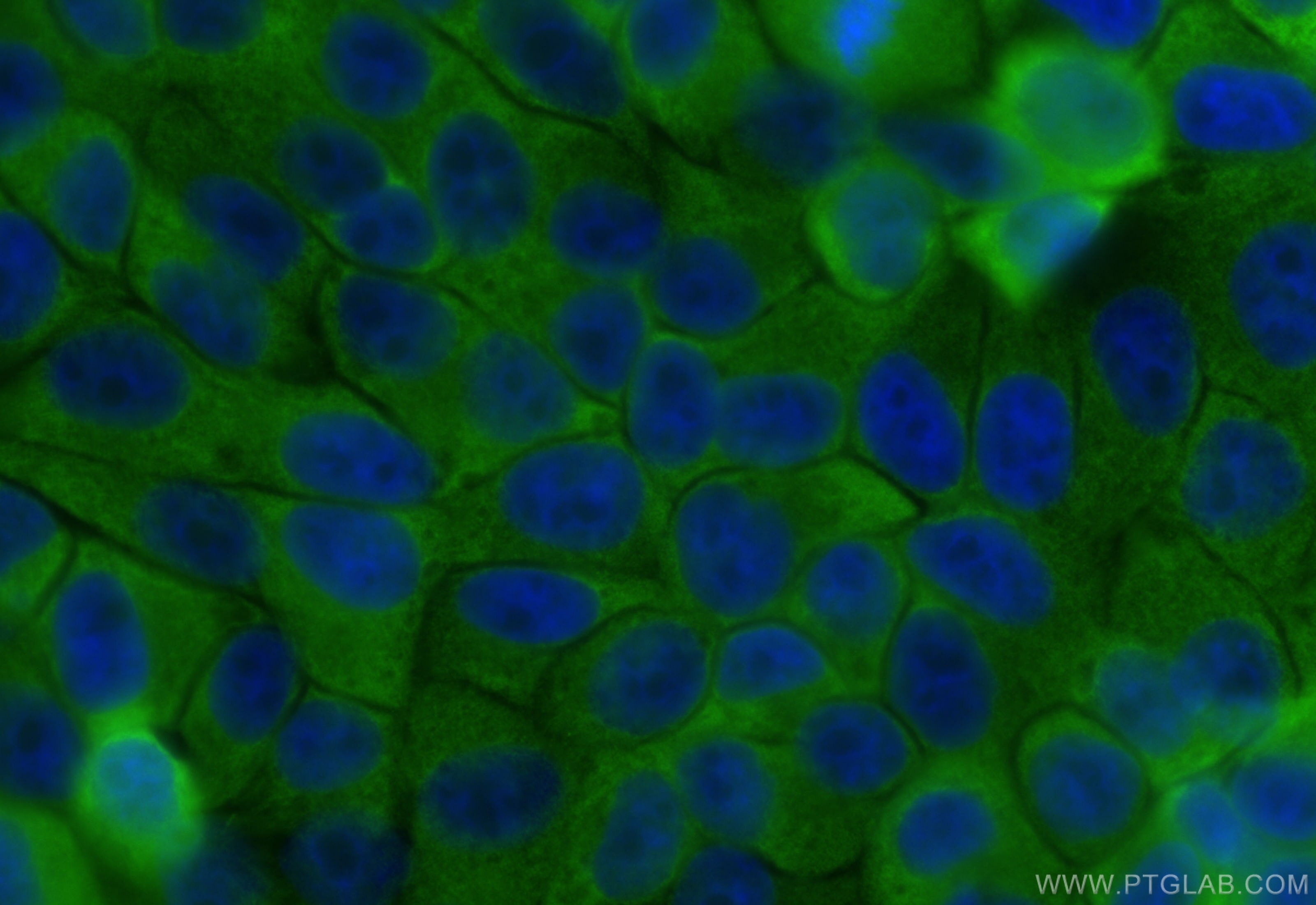 Immunofluorescence (IF) / fluorescent staining of HepG2 cells using SBDS Monoclonal antibody (67200-1-Ig)