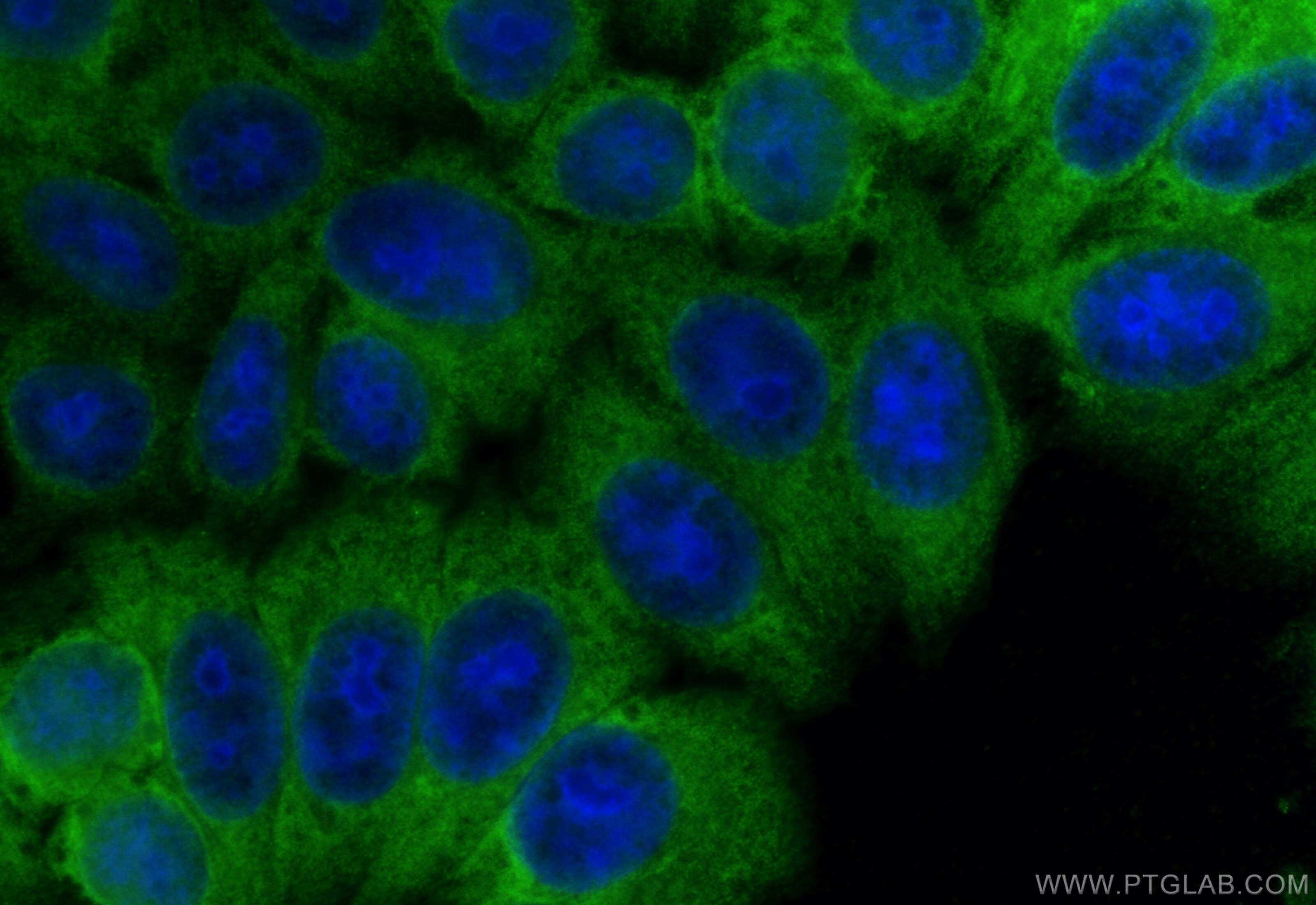 Immunofluorescence (IF) / fluorescent staining of HepG2 cells using SBDS Monoclonal antibody (67200-1-Ig)